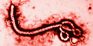 EBOLA-VIRUS